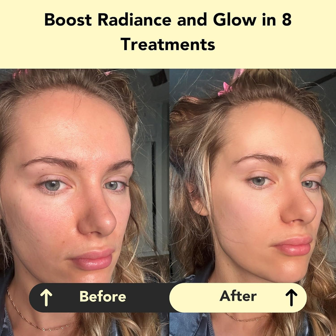 Glorio Brillo: 8 tratamientos de mascarilla de arcilla revitalizant...
