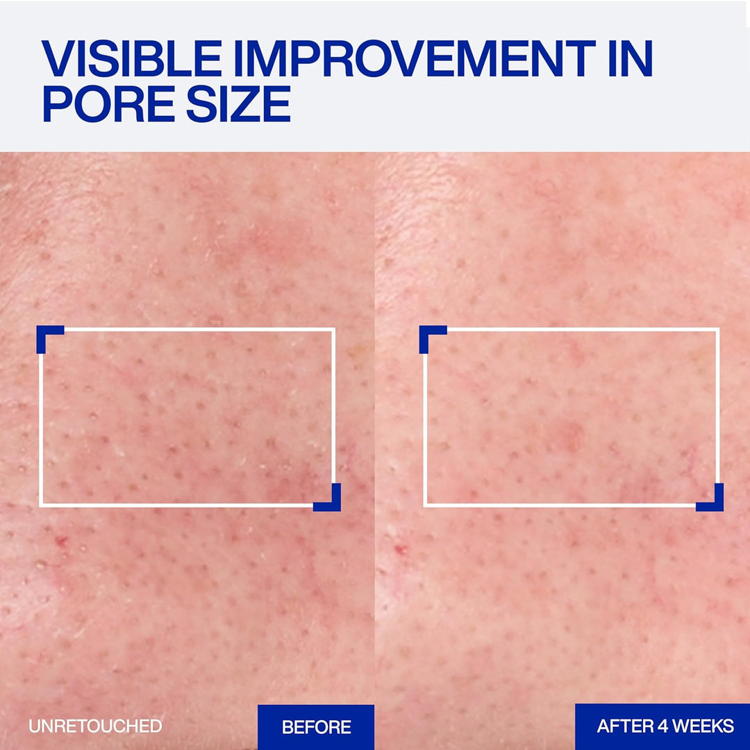 IOPE Expert Retinol RX 1% Super Bounce Serum - Suero facial antienv...
