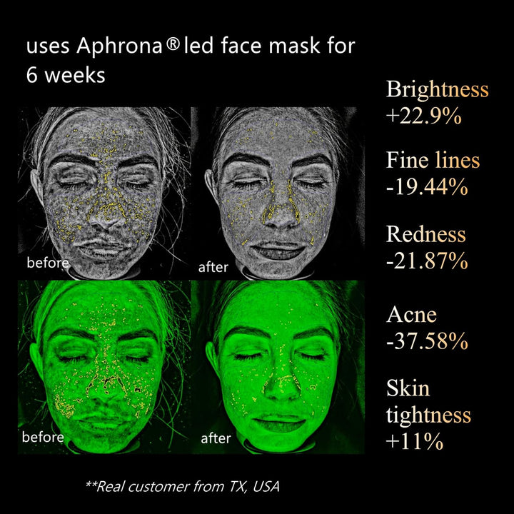 Aphrona Máscara facial con luces LED Halo, terapia de luz LED para...