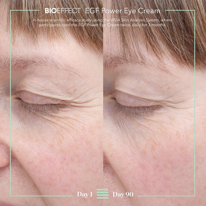 BIOEFFECT EGF Power Eye Cream | Tratamiento intensivo de ojos que d...