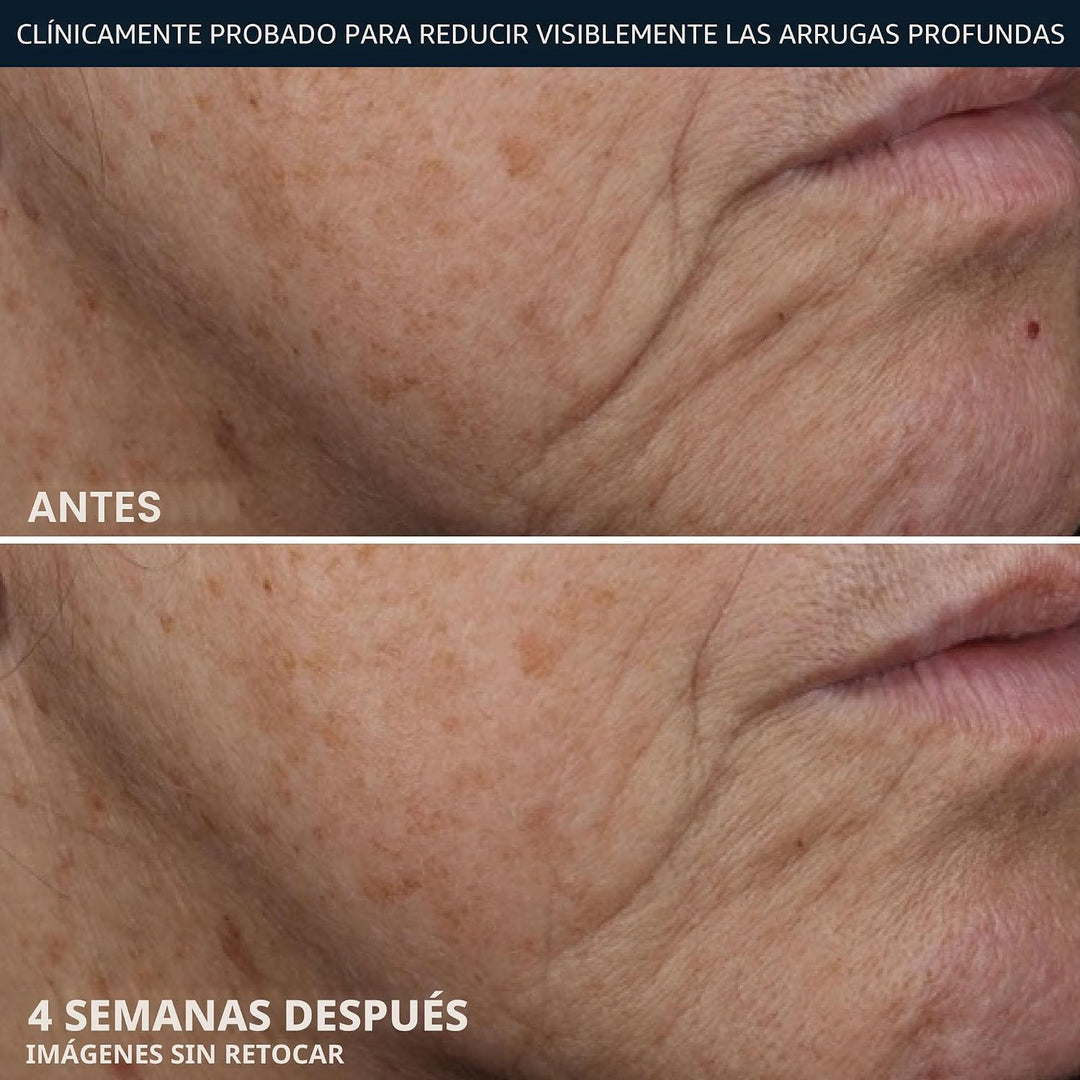 RoC Crema Rica para Arrugas Profundas, Sin Fragancia, Crema Reafirm...