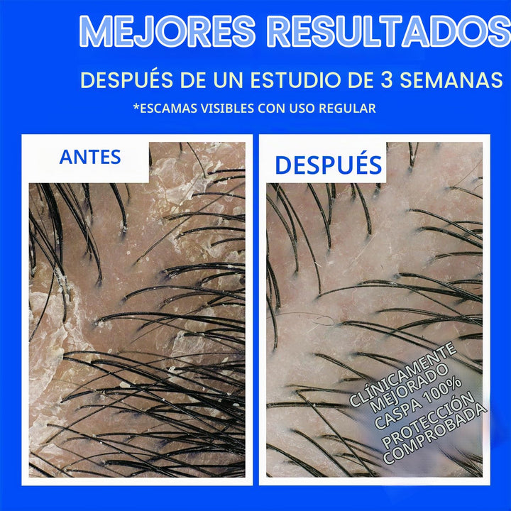 Head &amp; Shoulders Champú anticaspa, paquete doble de champú Clas...