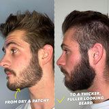 The Beard Club Supreme Kit de Crecimiento de Barba - Rodillo Derma,...