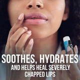ChapStick Paquete de 12 bálsamos labiales medicados a granel \u2013...