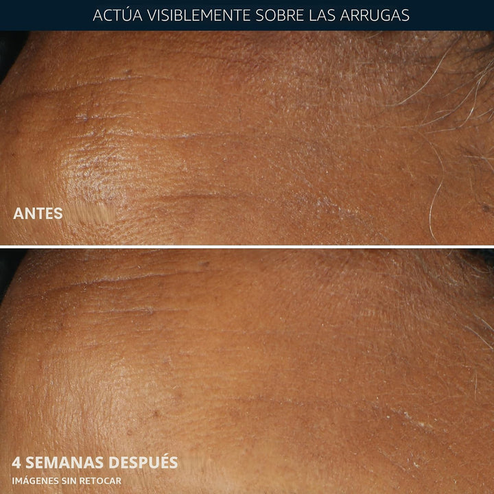 RoC Retinol Correxion Hidratante Facial Diario contra Arrugas Profu...