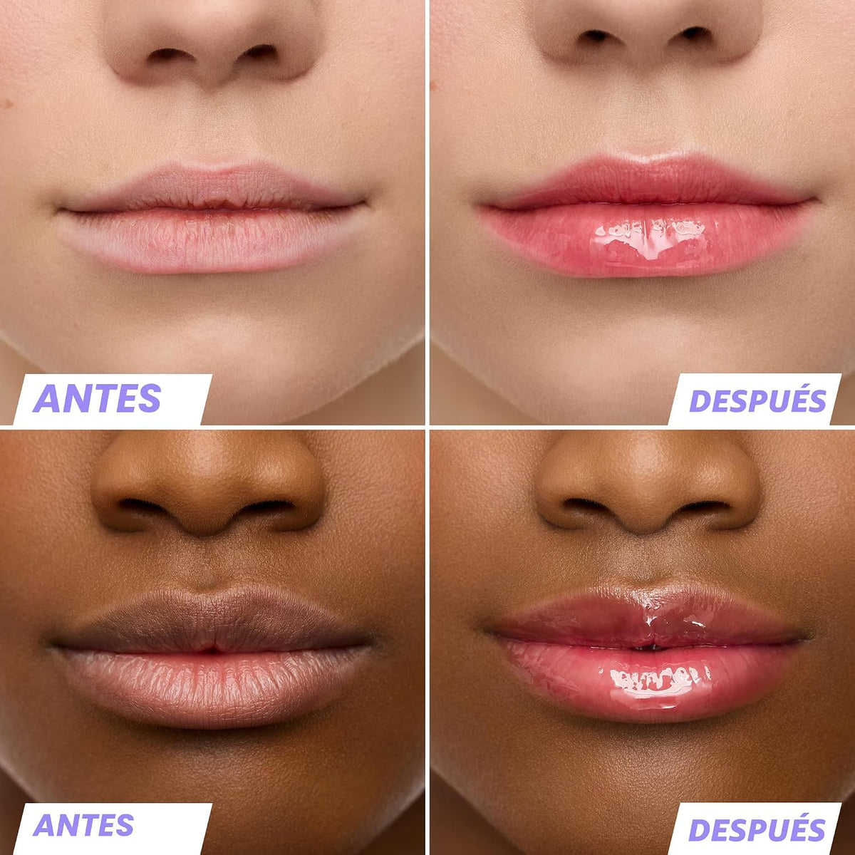 Wonderskin Suero de Rehabilitación de Aceite para Labios - Aceite L...
