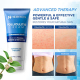 Hermon Crema de foliculitis: eficaz para la foliculitis cuero cabel...