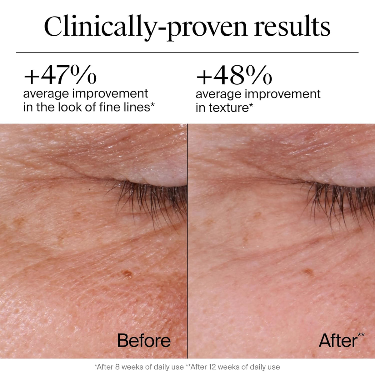 Neutrogena Hidratante facial de retinol de reparación rápida de arr...