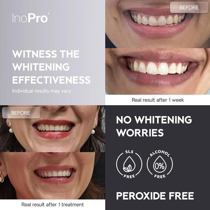 InoPro Kit de tiras blanqueadoras de dientes naturales 14 tratamien...