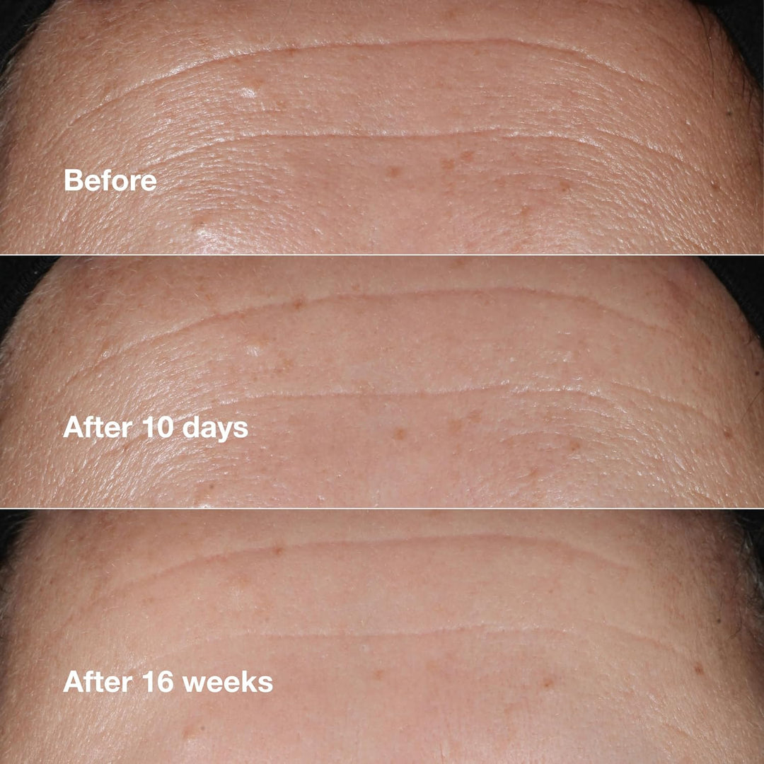 Clinique Smart Clinical Repair Suero facial antienvejecimiento corr...