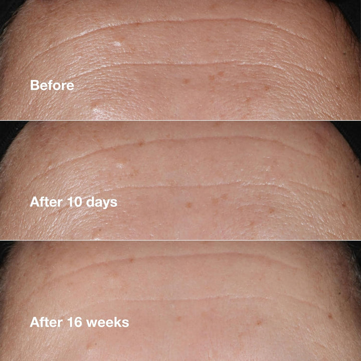 Clinique Smart Clinical Repair Suero facial antienvejecimiento corr...