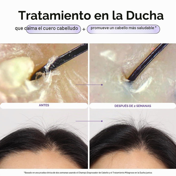 Dr. Groot Miracle in Shower - Tratamiento hidratante para la pérdid...