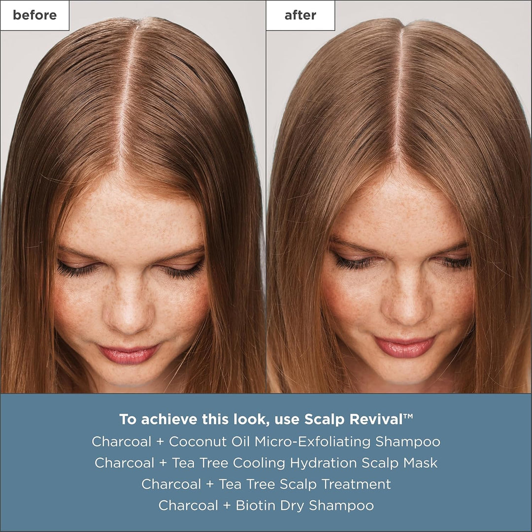 Briogeo Scalp Revival - Tratamiento para el cuero cabelludo con car...