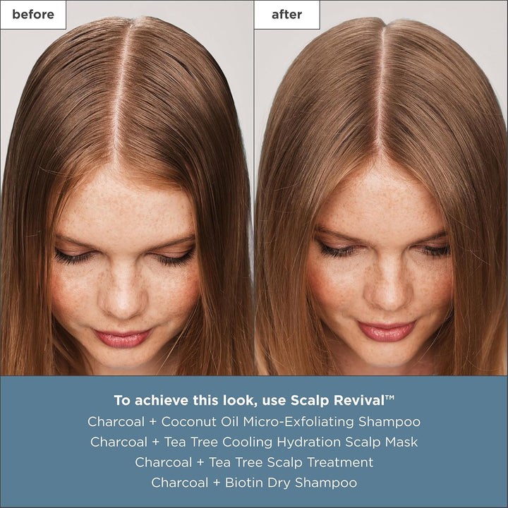 Briogeo Scalp Revival - Tratamiento para el cuero cabelludo con car...