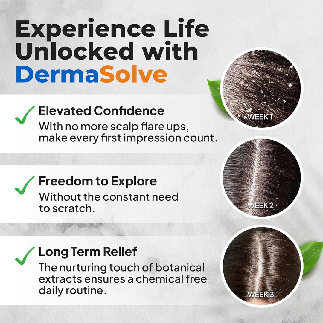 Dermasolve Aceite de psoriasis y caspa, aprobado por dermatólogos p...