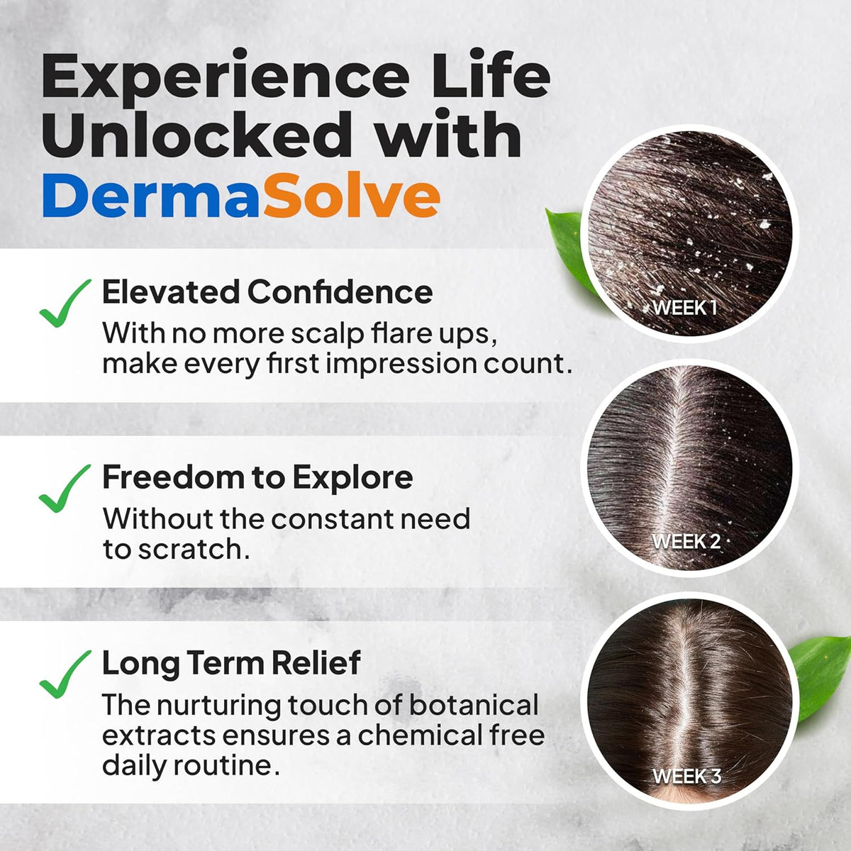 Dermasolve Aceite de psoriasis y caspa, aprobado por dermatólogos p...