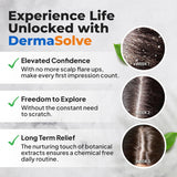 Dermasolve Aceite de psoriasis y caspa, aprobado por dermatólogos p...