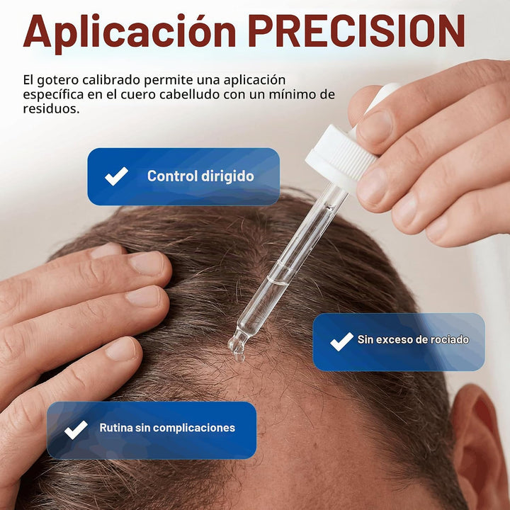 Minoxidil - Tratamiento líquido extra fuerte para el crecimiento de...