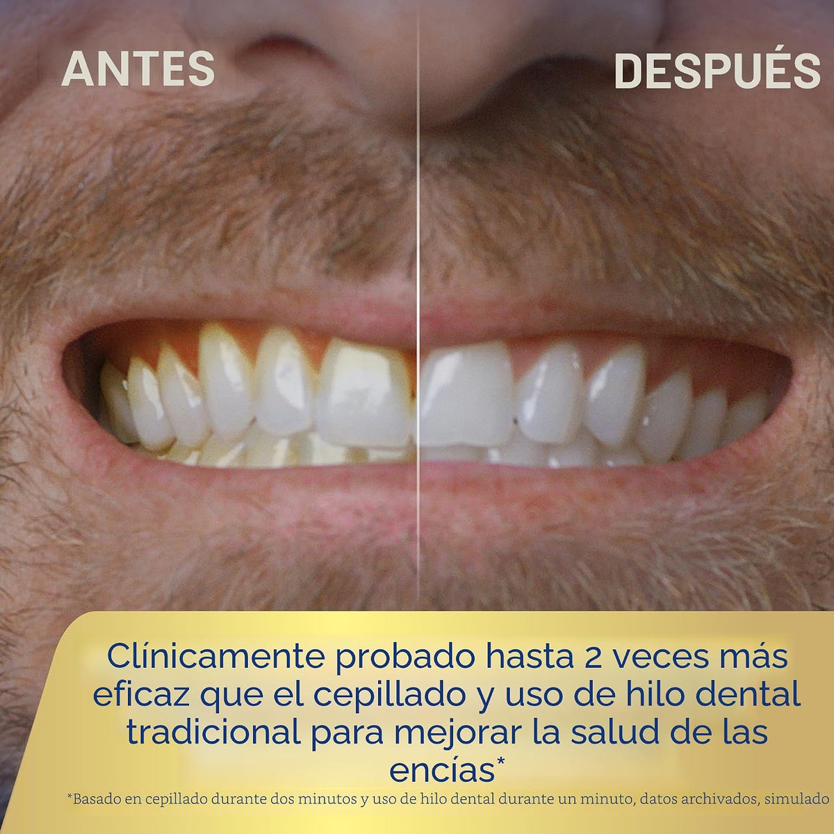 Waterpik Sonic - Cepillo de dientes e irrigador dental profesional...
