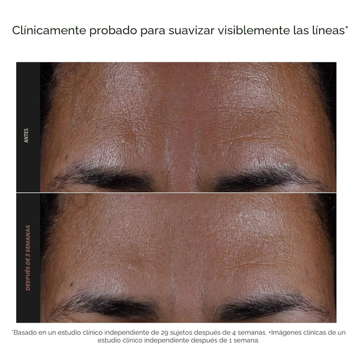 Paula's Choice SKIN PERFECTING 2% BHA Exfoliante líquido con ácido...