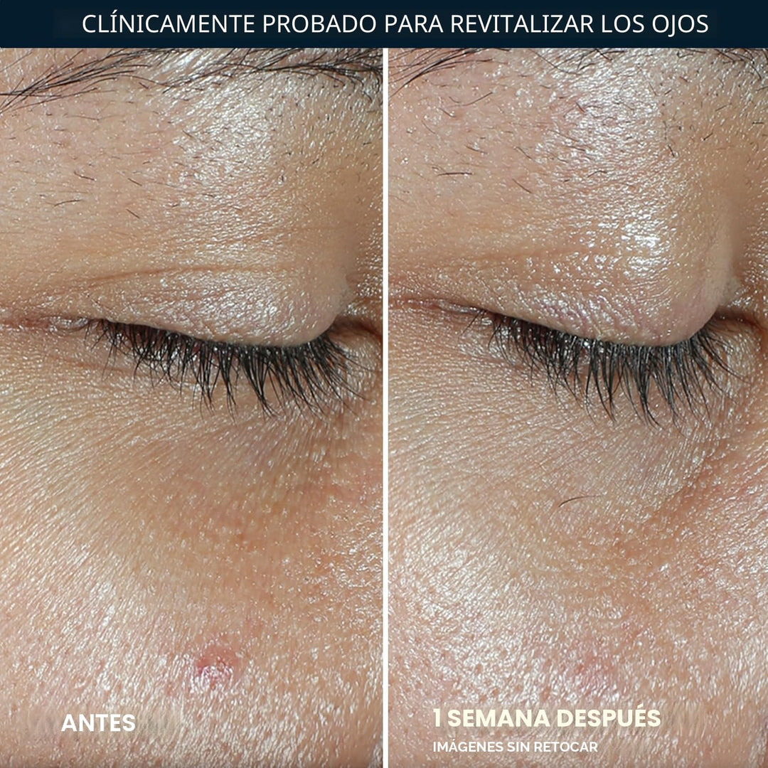 RoC Multi Correxion Revive + Glow Eye Balm con vitamina C (0.14 oz)...