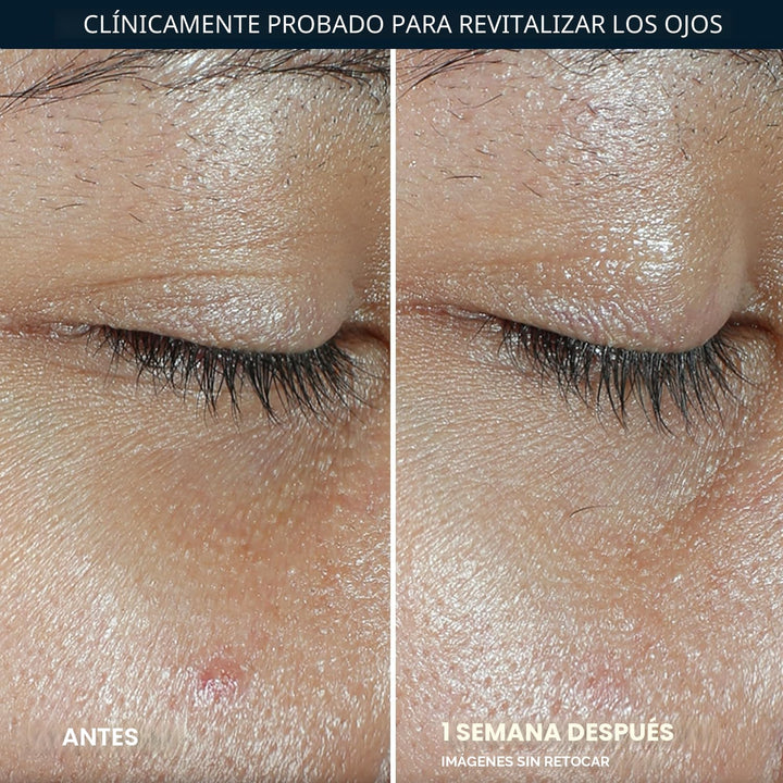RoC Multi Correxion Revive + Glow Eye Balm con vitamina C (0.14 oz)...