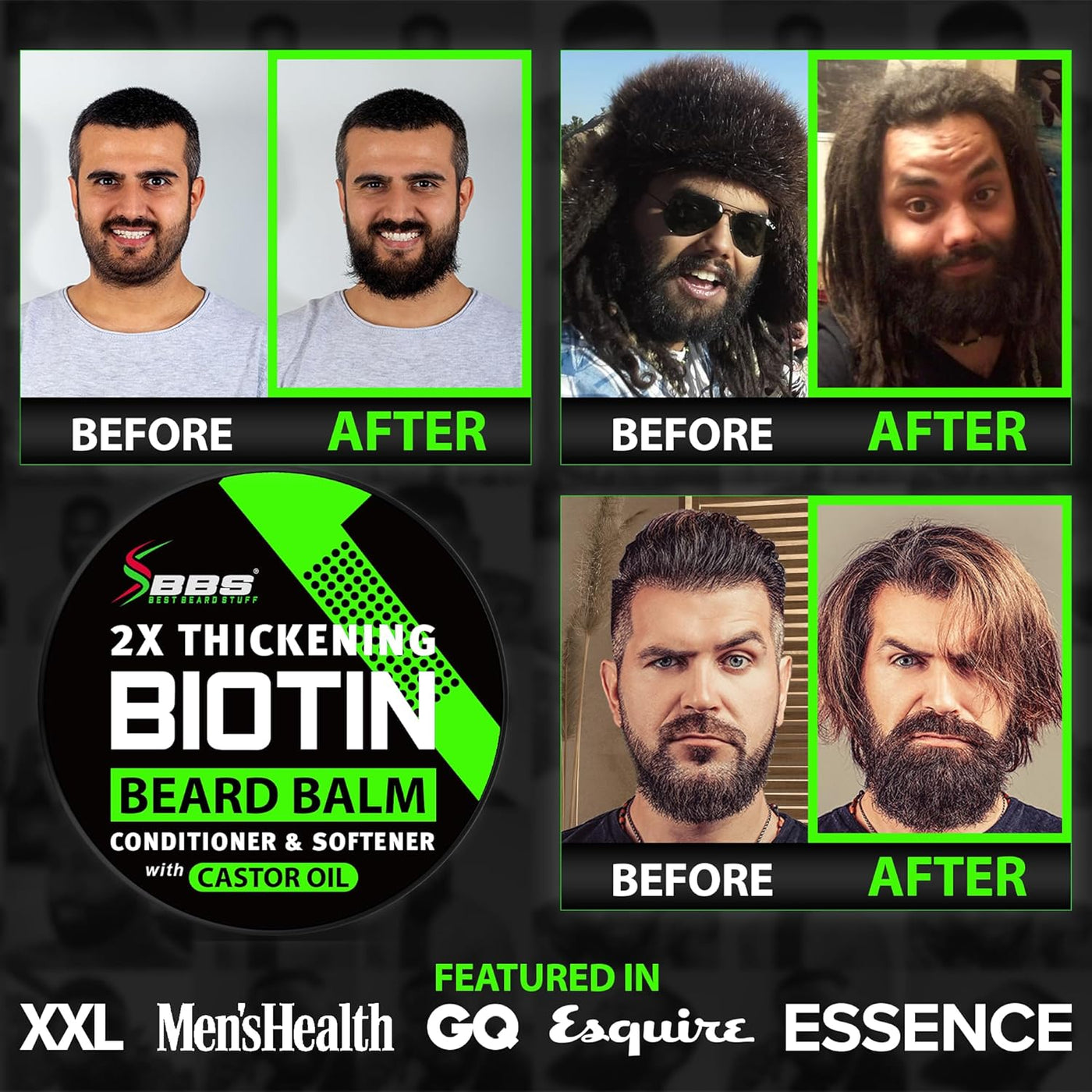 Biotin - Bálsamo para barba + suero para el crecimiento de la barba...