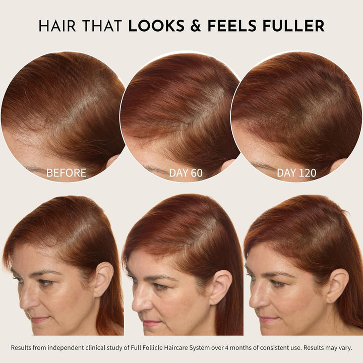 Maelove Full Follicle Advanced Scalp Serum - Tratamiento para engro...