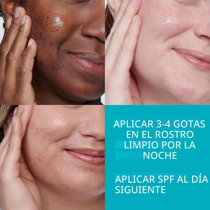 La Roche-Posay Effaclar - Suero de ácido salicílico al 1,5%, tratam...