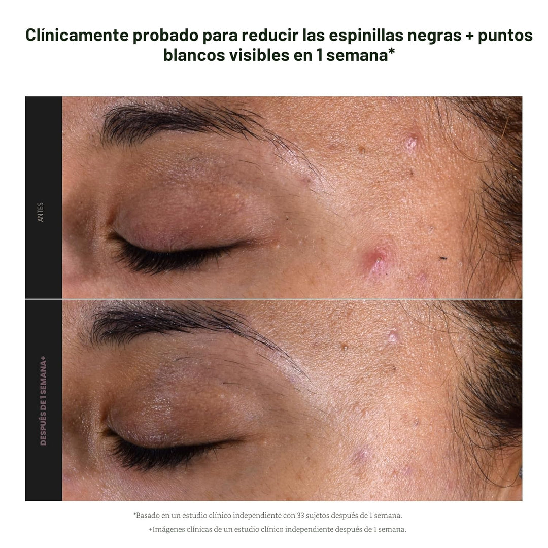 Paula's Choice SKIN PERFECTING 2% BHA Exfoliante líquido con ácido...