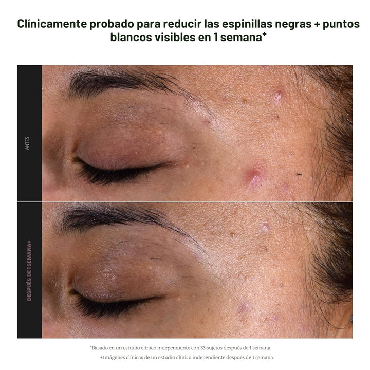 Paula's Choice SKIN PERFECTING 2% BHA Exfoliante líquido con ácido...