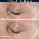 RoC Retinol Correxion Parches Dirigidos No Invasivos para Arrugas P...