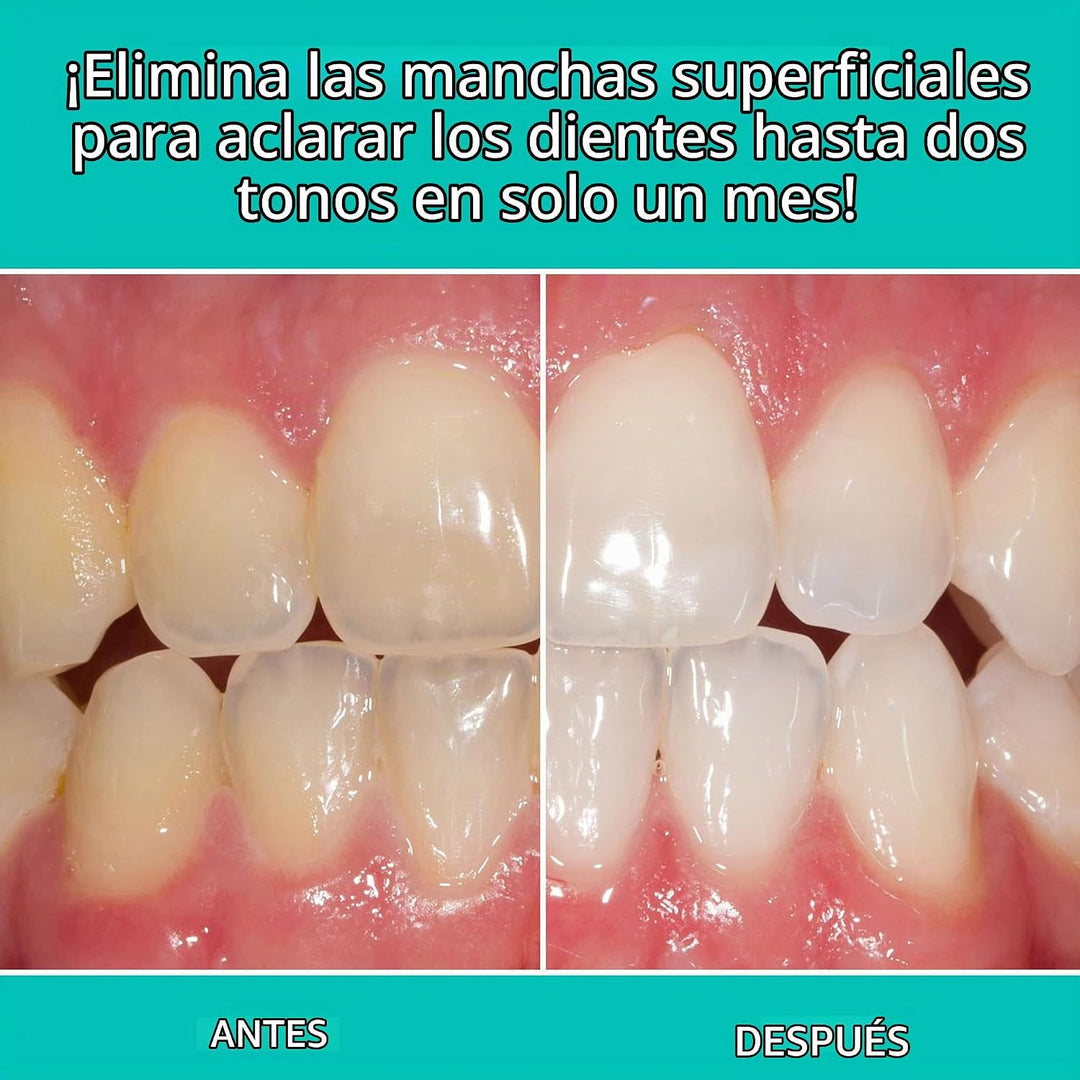 Opalescent Pasta de dientes blanqueadora para dientes sensibles (pa...