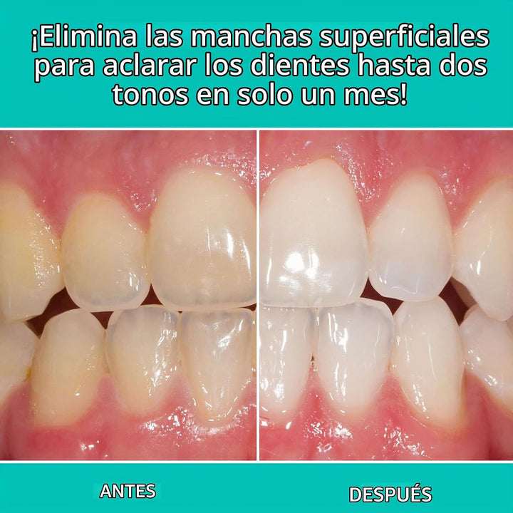 Opalescent Pasta de dientes blanqueadora para dientes sensibles (pa...