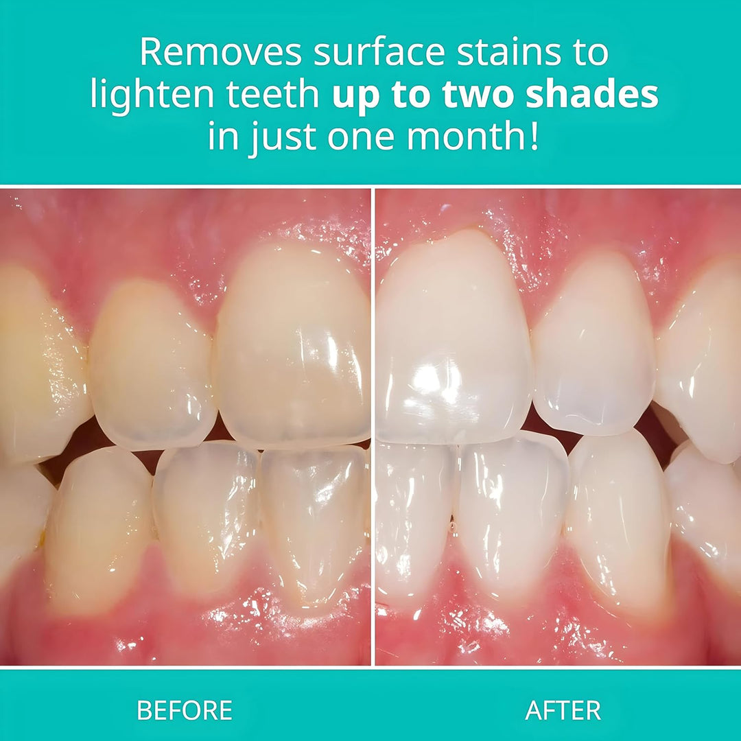 \u2022 Opalescence Pasta de dientes blanqueadora, pasta de dientes...