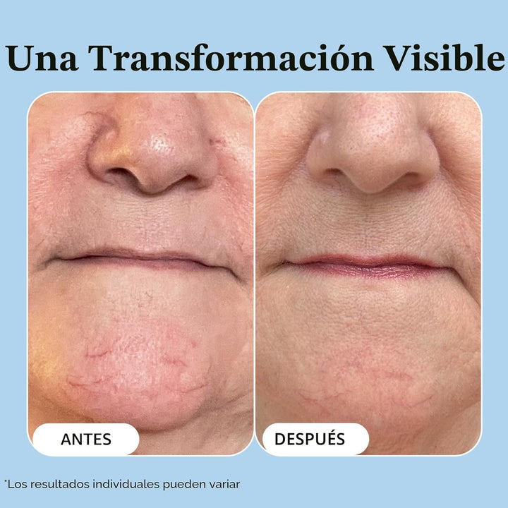 Vibriance Super C Serum para piel madura - Fórmula vitamínica todo...