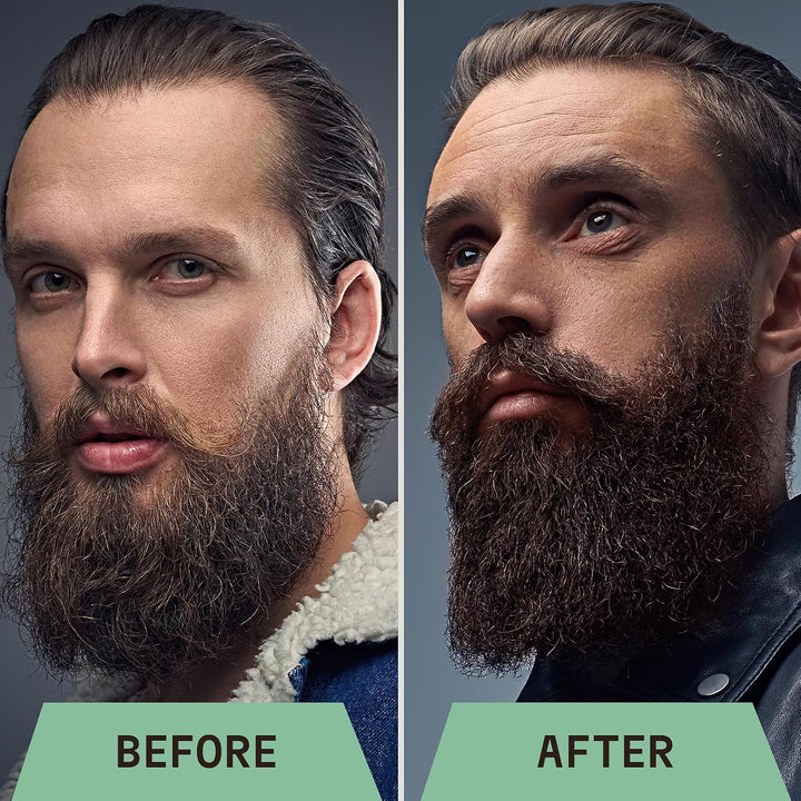 Striking Viking Champú para barba con árbol de té, biotina y aceite...