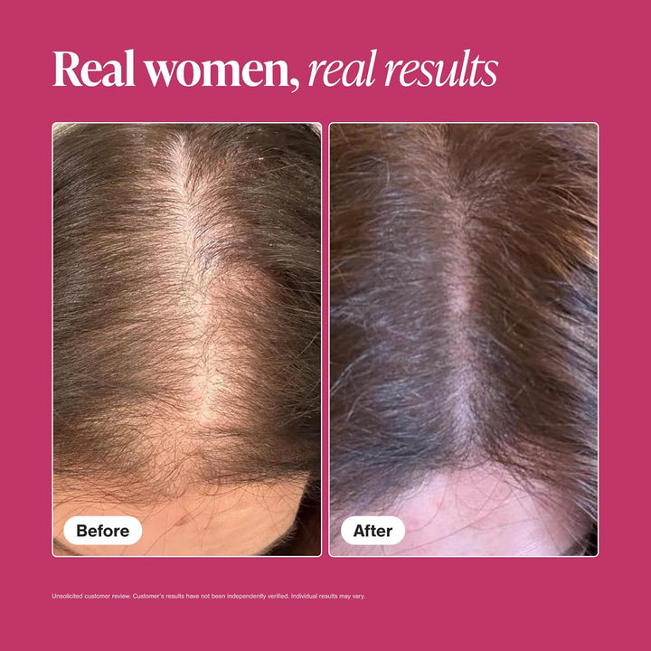 Viviscal Suplementos para el crecimiento del cabello para mujeres,...