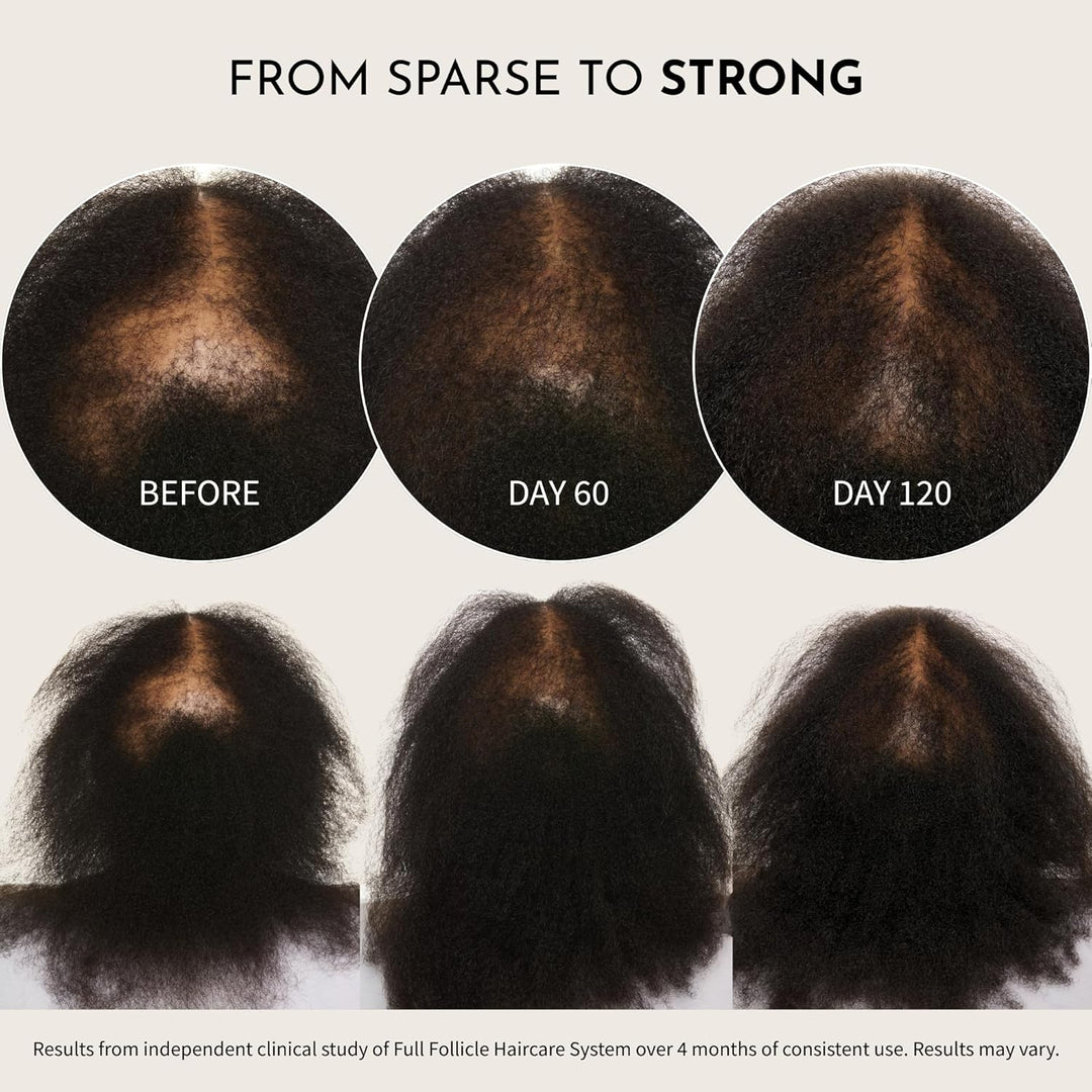 Maelove Full Follicle Advanced Scalp Serum - Tratamiento para engro...