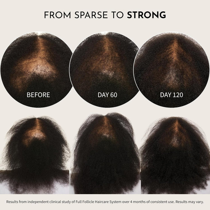 Maelove Full Follicle Advanced Scalp Serum - Tratamiento para engro...