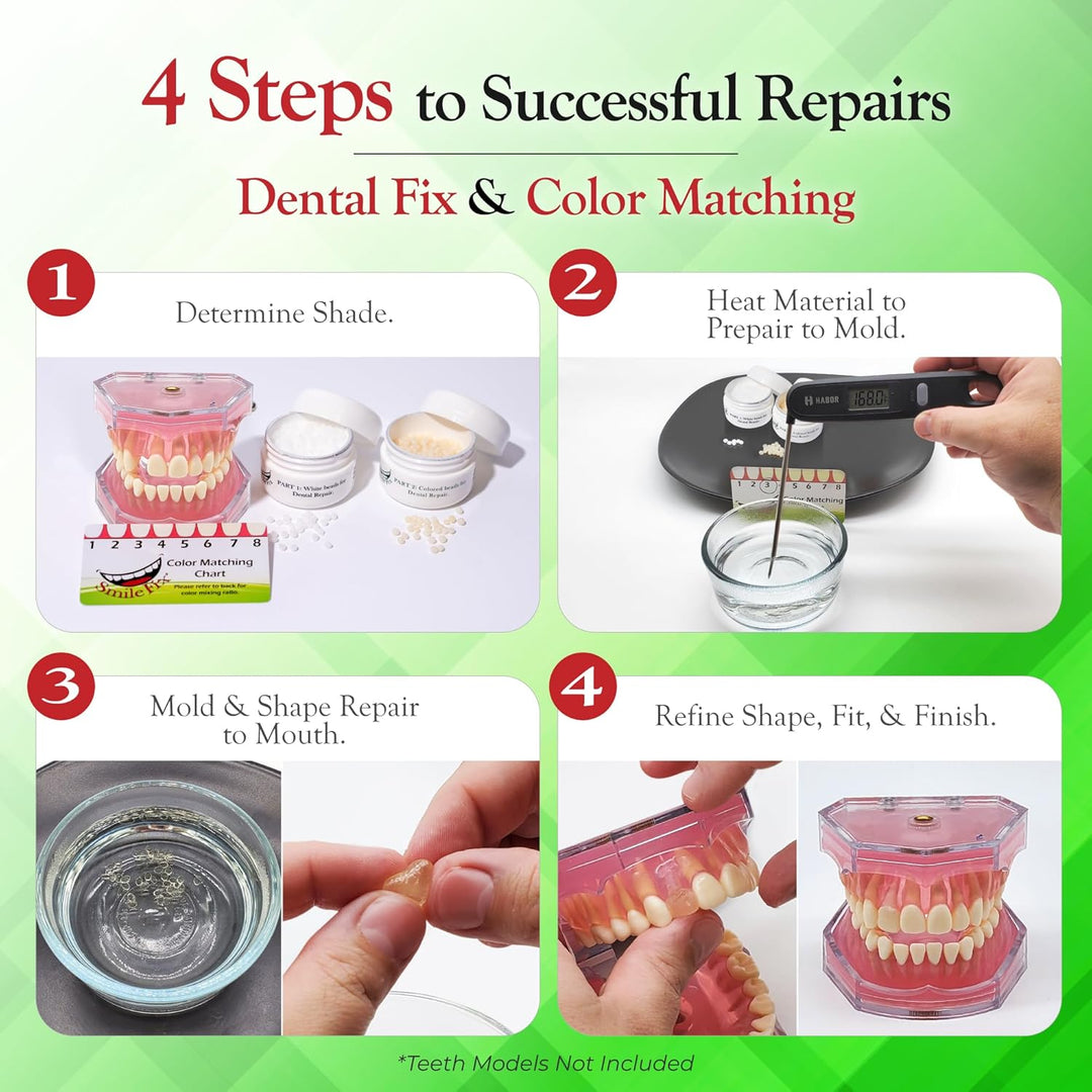 SmileFix Kit de reparación dental estándar - Compuesto de coloració...