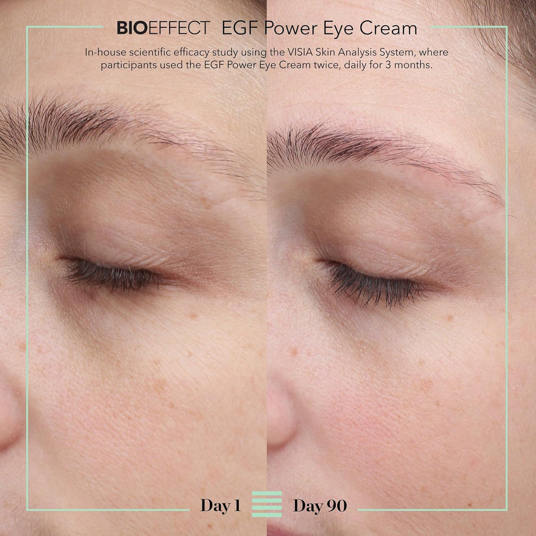 BIOEFFECT EGF Power Eye Cream | Tratamiento intensivo de ojos que d...