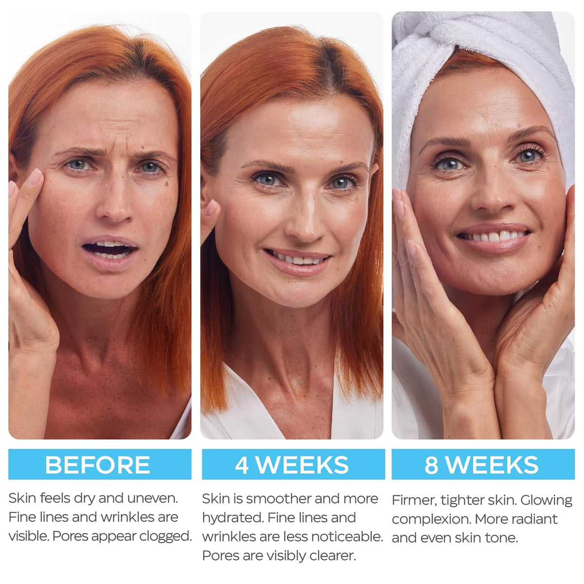 Crema de retinol para cara con ácido hialurónico \u2013 Hidratante...