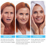 Crema de retinol para cara con ácido hialurónico \u2013 Hidratante...