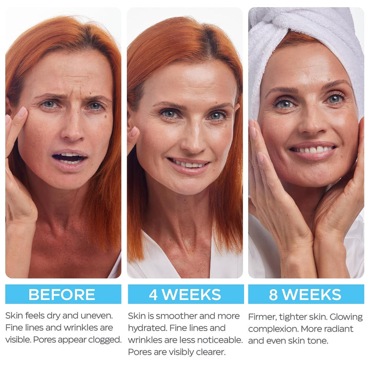 Crema de retinol para cara con ácido hialurónico \u2013 Hidratante...