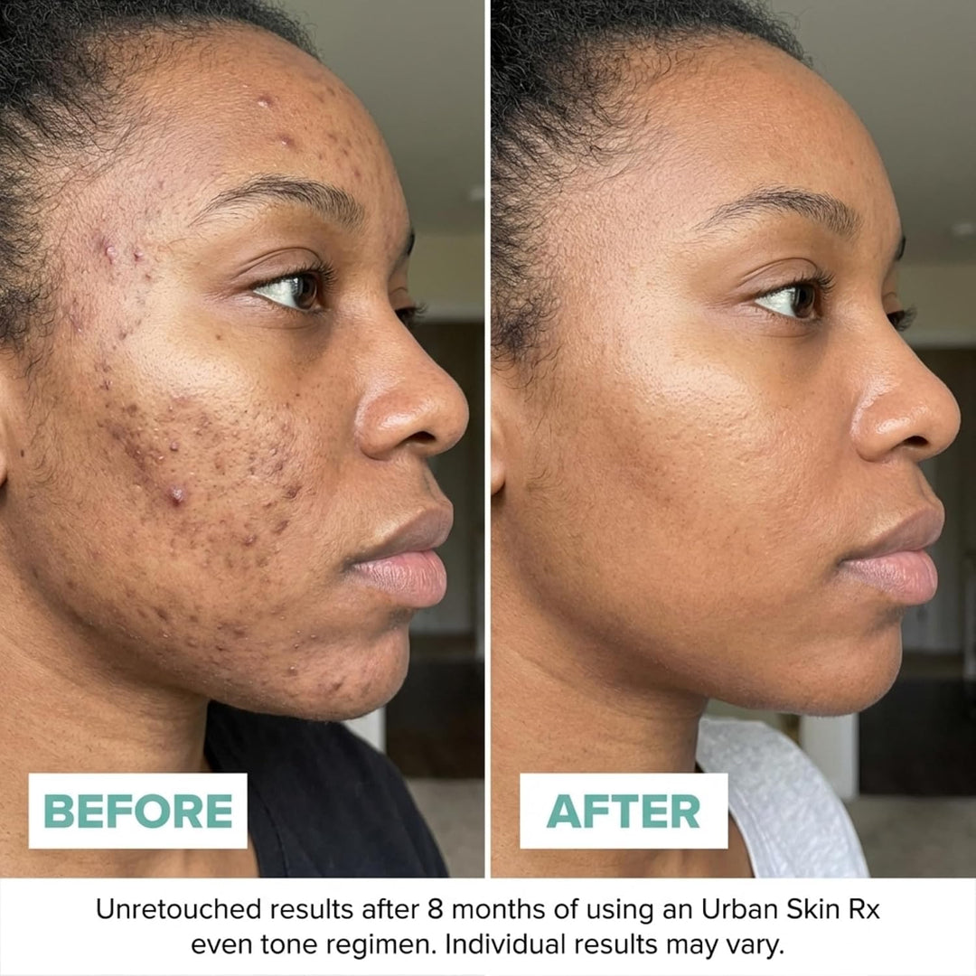 Urban Skin Rx Crema facial iluminadora diaria con vitamina C + E pa...
