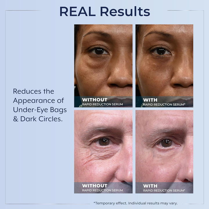 Plexaderm Suero de ojos de reducción rápida: reduce visiblemente la...