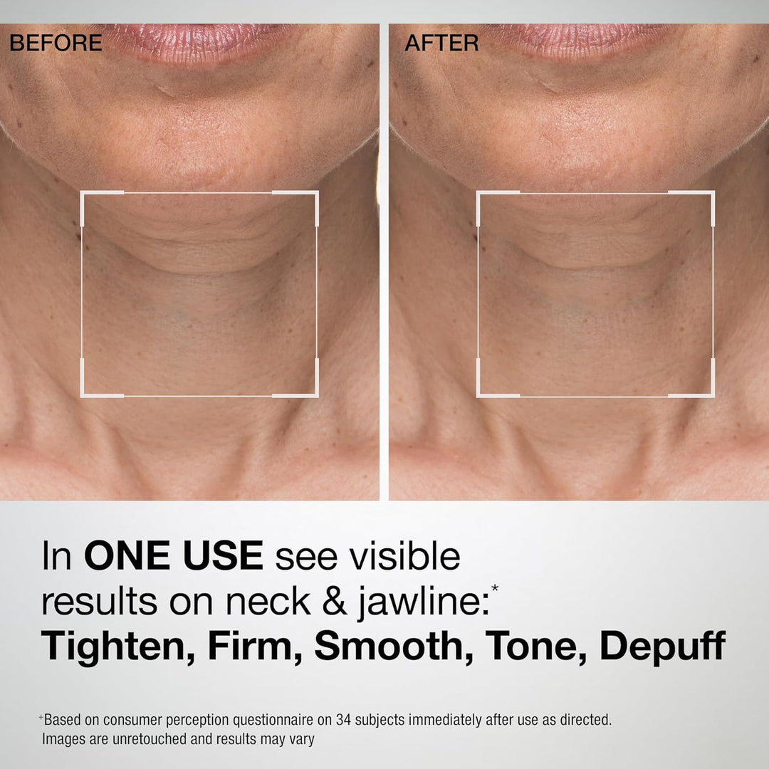 StriVectin Tighten and Lift Advanced Neck Cream PLUS with Alpha-3 P...