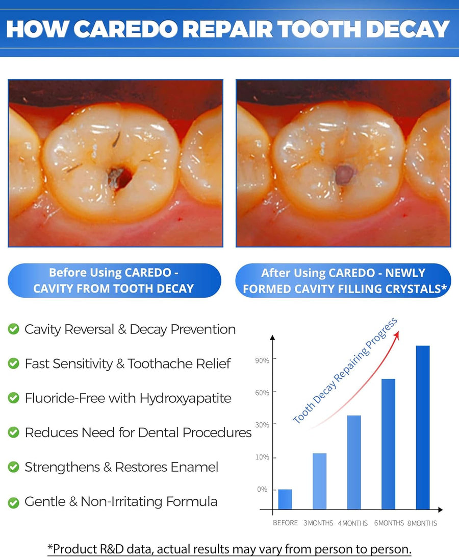 CAREDO Tratamiento de pasta de dientes para adultos, reparación de...