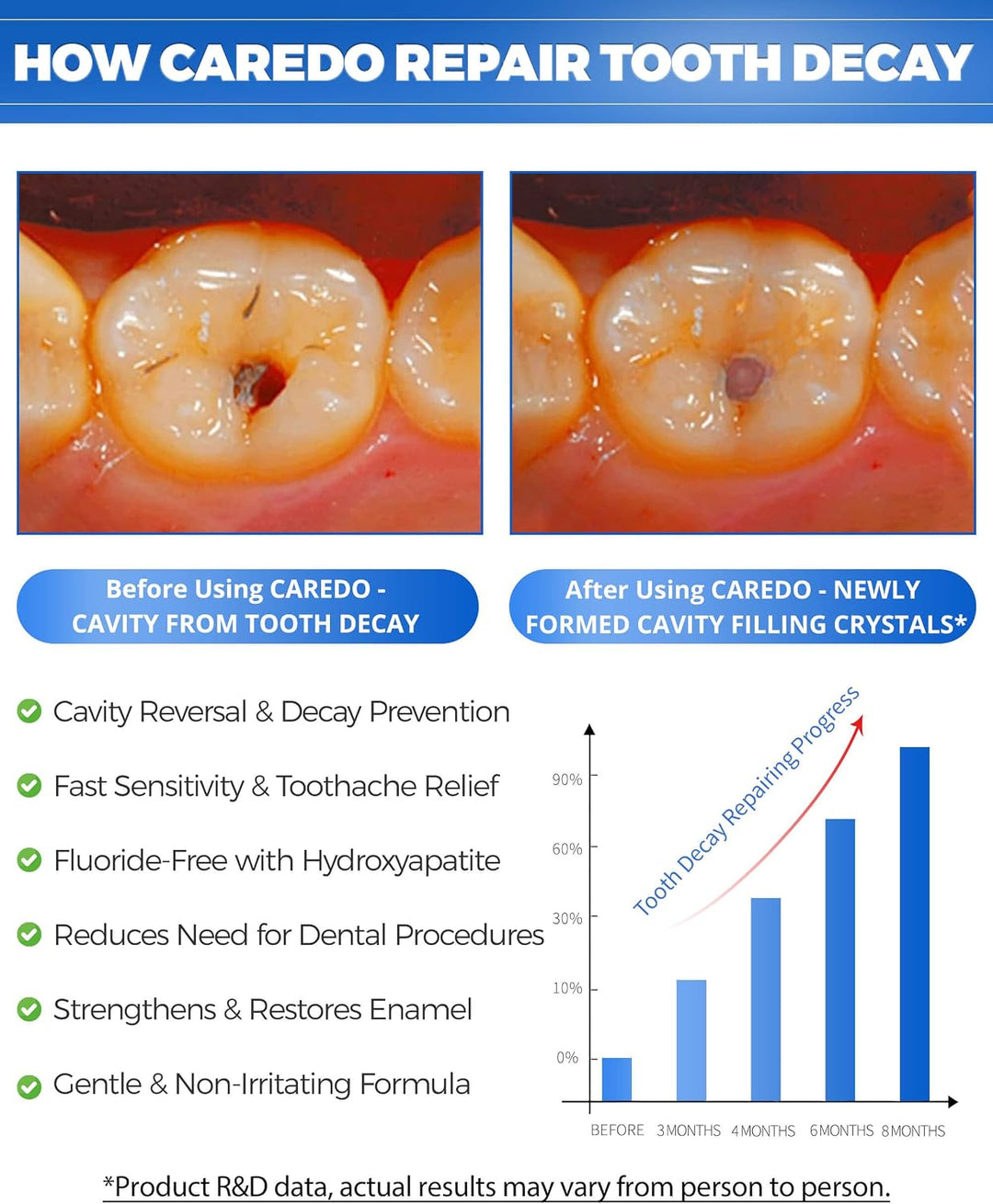 Sabor Mejorado - Pasta de Dientes de Hidroxiapatita CAREDO Cavity R...